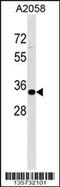 Zinc Finger Protein 570 antibody, 58-398, ProSci, Western Blot image 