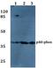 Neutrophil Cytosolic Factor 4 antibody, A04208, Boster Biological Technology, Western Blot image 