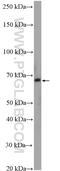 Zinc Finger Protein 570 antibody, 27811-1-AP, Proteintech Group, Western Blot image 