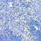 Succinate Dehydrogenase Complex Iron Sulfur Subunit B antibody, 13-817, ProSci, Immunohistochemistry paraffin image 