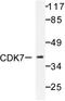 Cyclin Dependent Kinase 7 antibody, AP06446PU-N, Origene, Western Blot image 