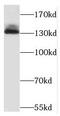 Non-SMC Condensin I Complex Subunit G antibody, FNab05578, FineTest, Western Blot image 