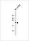 DnaJ Heat Shock Protein Family (Hsp40) Member C5 Gamma antibody, 59-260, ProSci, Western Blot image 