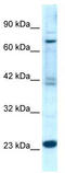 Regulator Of G Protein Signaling 10 antibody, TA330397, Origene, Western Blot image 
