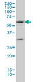 Suppressor of cytokine signaling 5 antibody, LS-C133600, Lifespan Biosciences, Western Blot image 