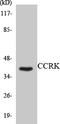 CDK-related protein kinase PNQLARE antibody, A13734, Boster Biological Technology, Western Blot image 