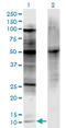 CDKN2A antibody, LS-C196886, Lifespan Biosciences, Western Blot image 