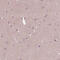 Coiled-Coil Domain Containing 114 antibody, HPA042524, Atlas Antibodies, Immunohistochemistry frozen image 