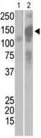 SARS Spike glycoprotein antibody, abx032684, Abbexa, Western Blot image 