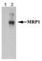 ATP Binding Cassette Subfamily C Member 1 antibody, NB110-57131, Novus Biologicals, Western Blot image 