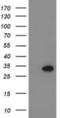 Potassium Channel Tetramerization Domain Containing 14 antibody, NBP2-00470, Novus Biologicals, Western Blot image 