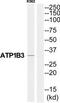 Sodium/potassium-transporting ATPase subunit beta-3 antibody, TA311900, Origene, Western Blot image 