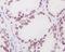 Androgen Receptor antibody, M00542-2, Boster Biological Technology, Immunohistochemistry frozen image 