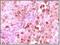 S100 Calcium Binding Protein A6 antibody, NB100-1765, Novus Biologicals, Immunohistochemistry frozen image 