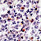 Perforin 1 antibody, LS-C87866, Lifespan Biosciences, Immunohistochemistry paraffin image 