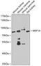 Meprin A Subunit Alpha antibody, GTX66511, GeneTex, Western Blot image 