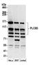 Phospholipase C Beta 3 antibody, A305-333A, Bethyl Labs, Western Blot image 