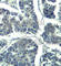 Phospholipase C Gamma 2 antibody, AP0429, ABclonal Technology, Immunohistochemistry paraffin image 