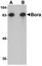 BORA Aurora Kinase A Activator antibody, PA5-20709, Invitrogen Antibodies, Western Blot image 