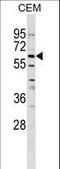 HGFIN antibody, LS-C159762, Lifespan Biosciences, Western Blot image 