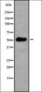 Cytochrome P450 11B2, mitochondrial antibody, orb336276, Biorbyt, Western Blot image 