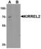 Kirre Like Nephrin Family Adhesion Molecule 2 antibody, MBS153480, MyBioSource, Western Blot image 