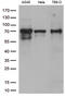 Zinc finger protein with KRAB and SCAN domains 1 antibody, LS-C795675, Lifespan Biosciences, Western Blot image 