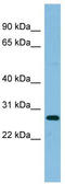 Ribosomal Protein L10a antibody, TA345126, Origene, Western Blot image 
