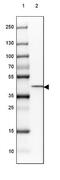 Corticosteroid 11-beta-dehydrogenase isozyme 2 antibody, NBP2-37898, Novus Biologicals, Western Blot image 