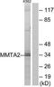 Chromosome 1 Open Reading Frame 35 antibody, TA315777, Origene, Western Blot image 