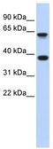 Epsin 2 antibody, TA329769, Origene, Western Blot image 