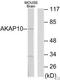 A-Kinase Anchoring Protein 10 antibody, TA326100, Origene, Western Blot image 