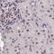Coiled-Coil Domain Containing 86 antibody, NBP1-93501, Novus Biologicals, Immunohistochemistry paraffin image 