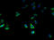 Zinc Finger DHHC-Type Containing 2 antibody, A61870-100, Epigentek, Immunofluorescence image 
