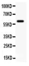 Potassium Calcium-Activated Channel Subfamily N Member 4 antibody, PA1047-1, Boster Biological Technology, Western Blot image 