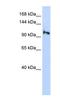 SMG5 Nonsense Mediated MRNA Decay Factor antibody, NBP1-56778, Novus Biologicals, Western Blot image 