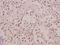 Ribosomal Protein L27a antibody, A07864-1, Boster Biological Technology, Immunohistochemistry paraffin image 