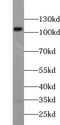 Transient Receptor Potential Cation Channel Subfamily C Member 5 antibody, FNab09018, FineTest, Western Blot image 