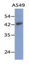 Layilin antibody, GTX53736, GeneTex, Western Blot image 