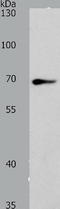 Spermatogenesis Associated 13 antibody, TA323980, Origene, Western Blot image 