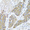 Peroxisomal Biogenesis Factor 14 antibody, A03327-2, Boster Biological Technology, Immunohistochemistry paraffin image 