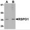 R-Spondin 1 antibody, MBS150333, MyBioSource, Western Blot image 