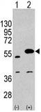 Sprouty Related EVH1 Domain Containing 1 antibody, AP11428PU-N, Origene, Western Blot image 