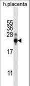 Human Chorionic gonadotrophin antibody, LS-C168712, Lifespan Biosciences, Western Blot image 