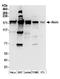 Alsin Rho Guanine Nucleotide Exchange Factor ALS2 antibody, A304-511A, Bethyl Labs, Western Blot image 