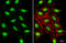 Histone-lysine N-methyltransferase SUV39H1 antibody, GTX112263, GeneTex, Immunocytochemistry image 