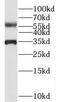 BEN Domain Containing 4 antibody, FNab00862, FineTest, Western Blot image 