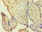 HNRNPH1 antibody, CSB-PA010609HA01HU, Cusabio, Immunohistochemistry paraffin image 