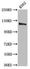 Centromere Protein J antibody, LS-C673936, Lifespan Biosciences, Western Blot image 