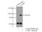 Nuclear Cap Binding Protein Subunit 1 antibody, 10349-1-AP, Proteintech Group, Immunoprecipitation image 